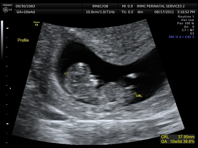 Letters to Baby: Week 25