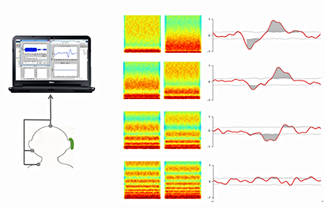 cochlear slideshow 2.png