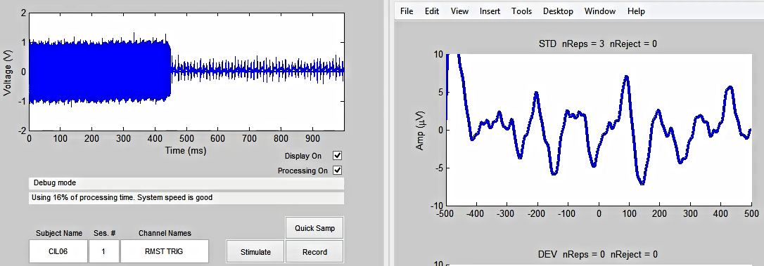 cochlear slideshow 4.gif