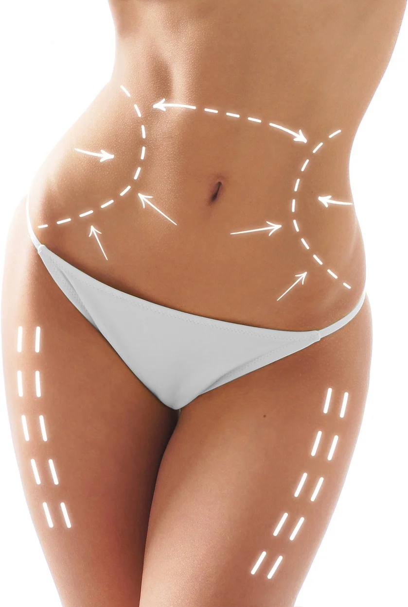 Body contouring Cryosthetics.jpg