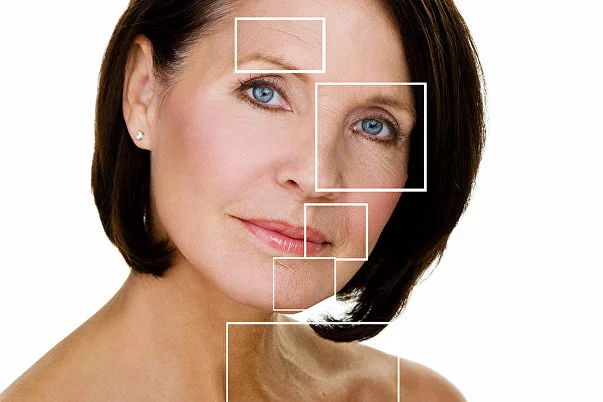 Botox+Areas.jpg