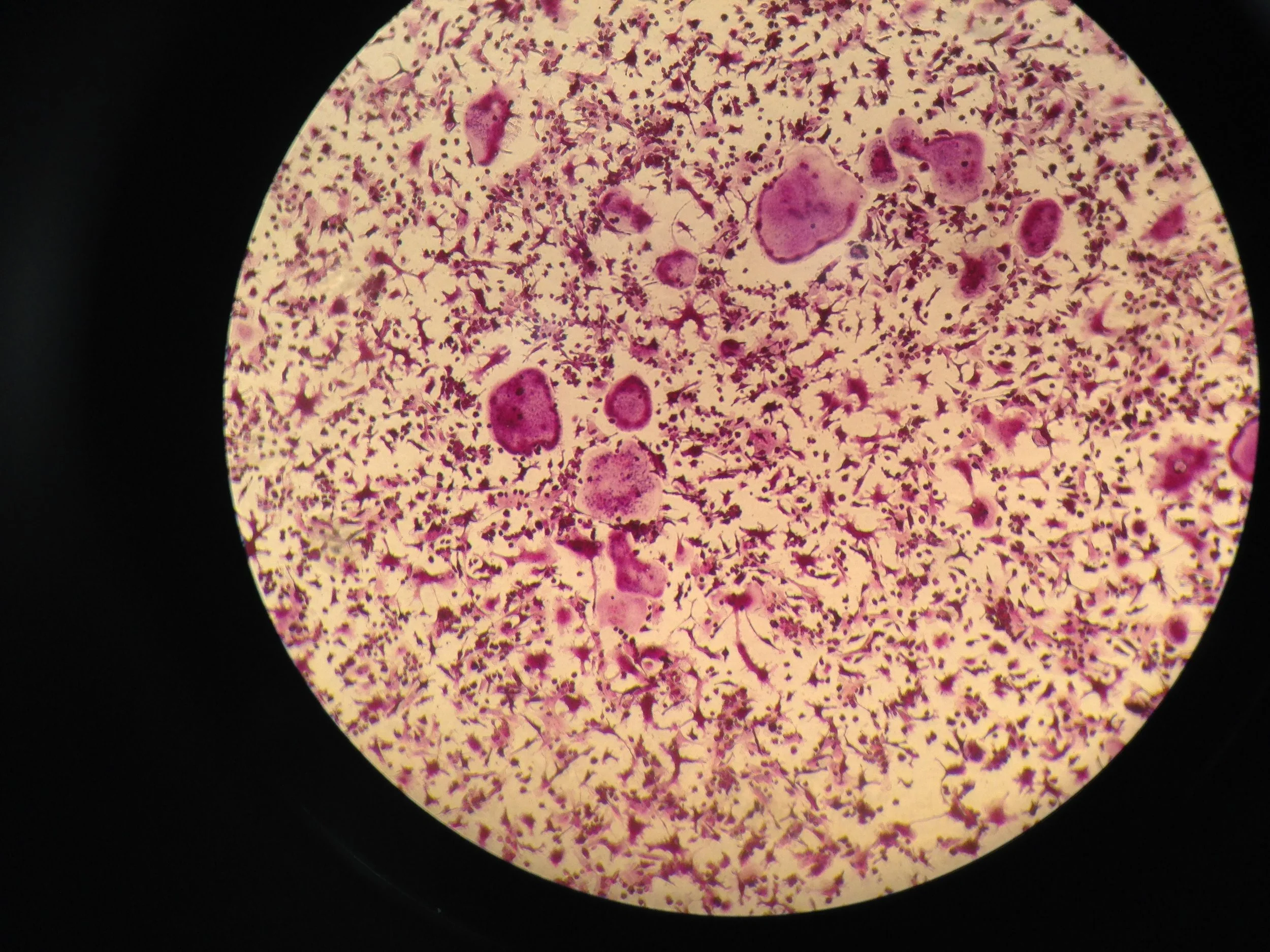 Osteoclasts in culture.JPG