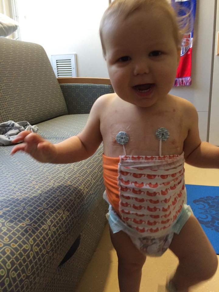 Luka, in his "tube top" to help hide his two central lines and three lumens