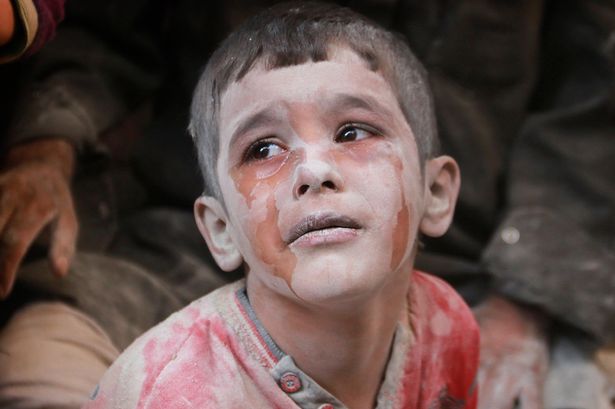 "Look at me, I am the eyes of suffering. I am Syria!