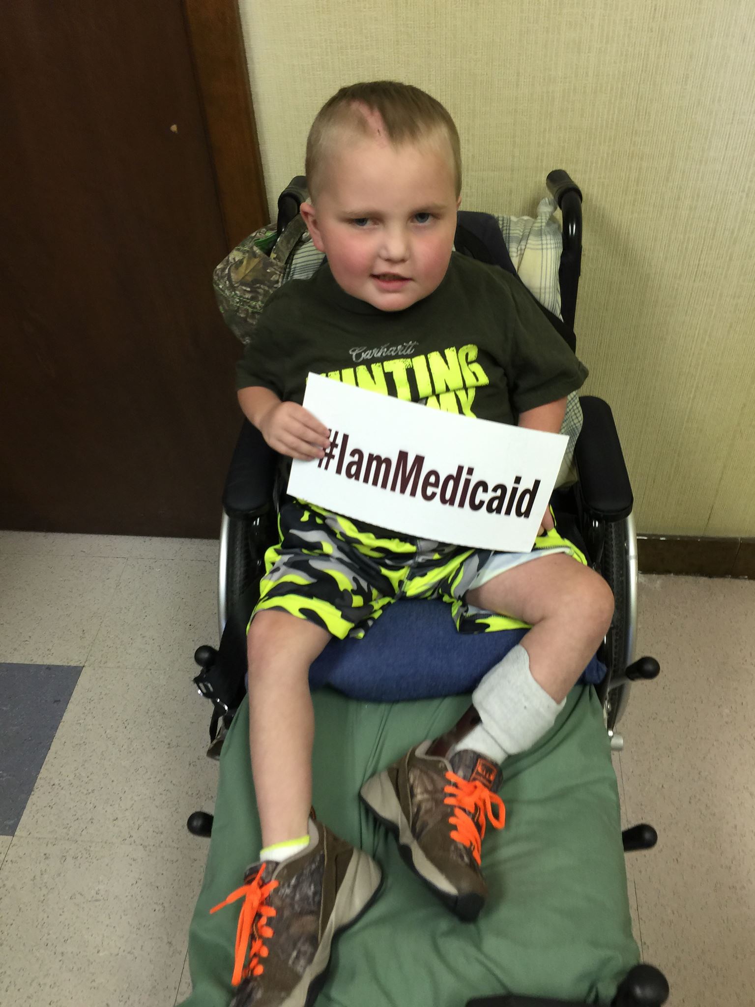  I have Hirschsprungs Syndrome, short-gut and am recovering from brain surgery after having a CNS infection. I am doing great now thanks to Medicaid!&nbsp;‪#‎IamMedicaid  