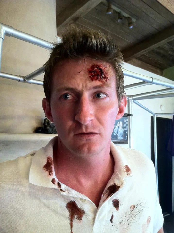 Gruesome Injury.jpeg