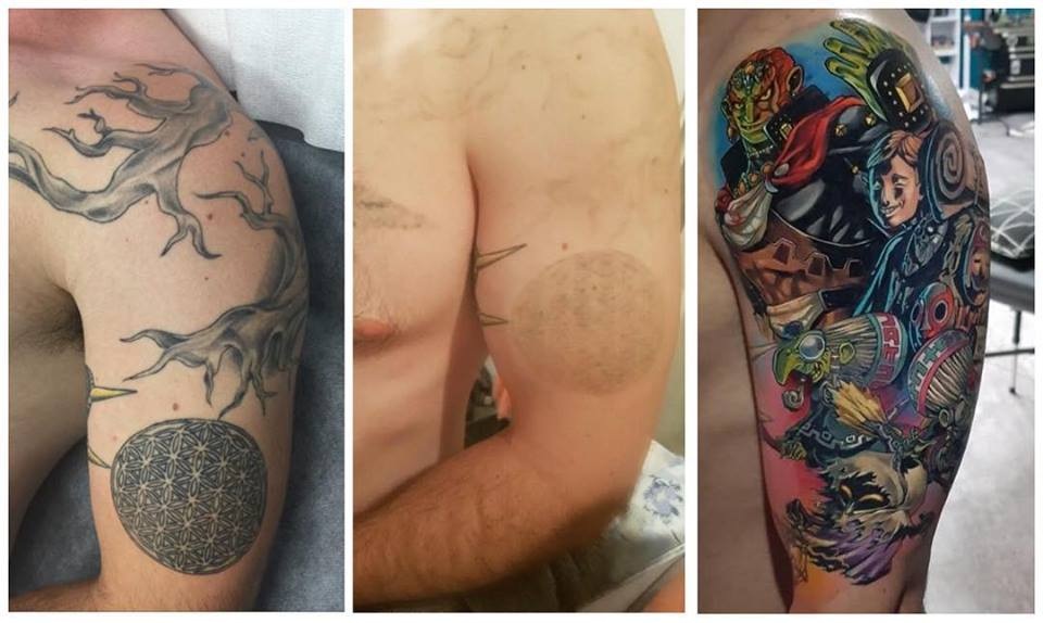 How Long After Laser Tattoo Removal Will the Tattoo Completely Fade   Binghamton Laser Tattoo Removal
