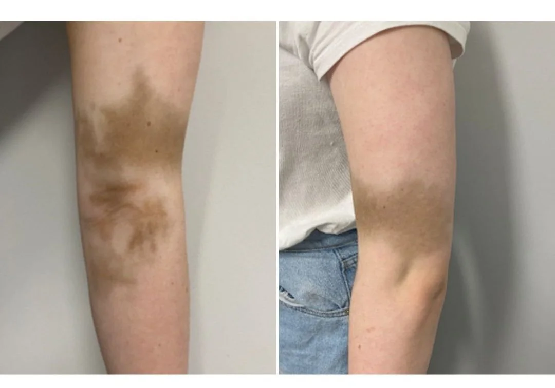 Conquering the impossible