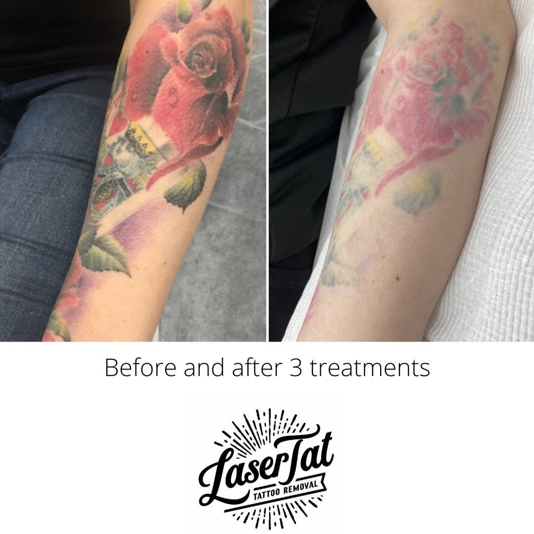 CLIENT PROGRESS