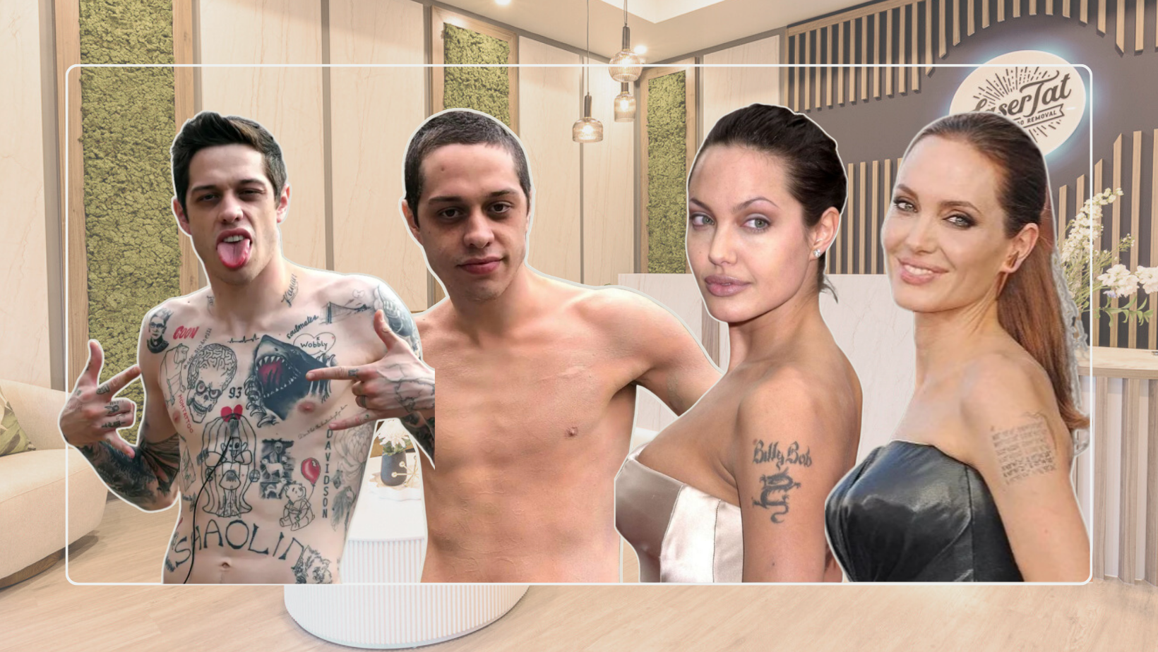 Celebrity Tattoo Removal Transformations – The reasons why they went under the laser!