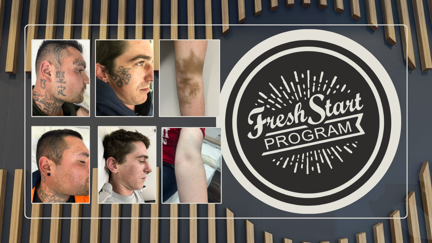 LaserTat’s Fresh Start Program: Client success stories
