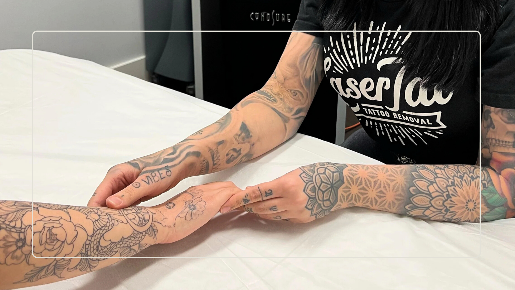 Pain Management: Exploring effective options for laser tattoo removal.