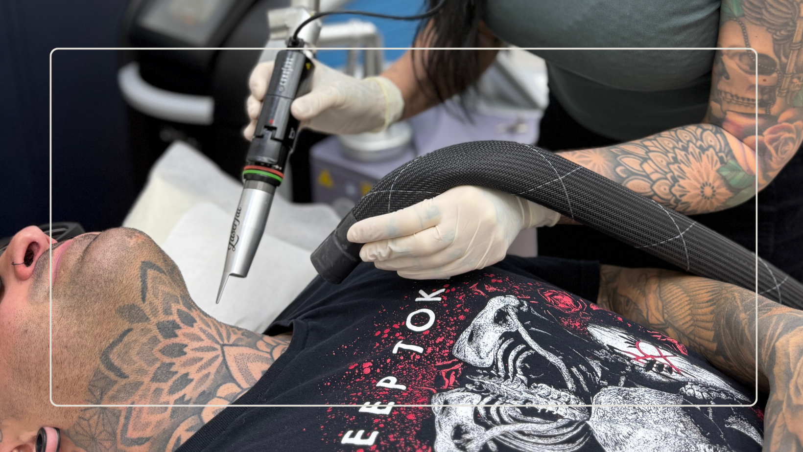 10 things you need to know before starting laser