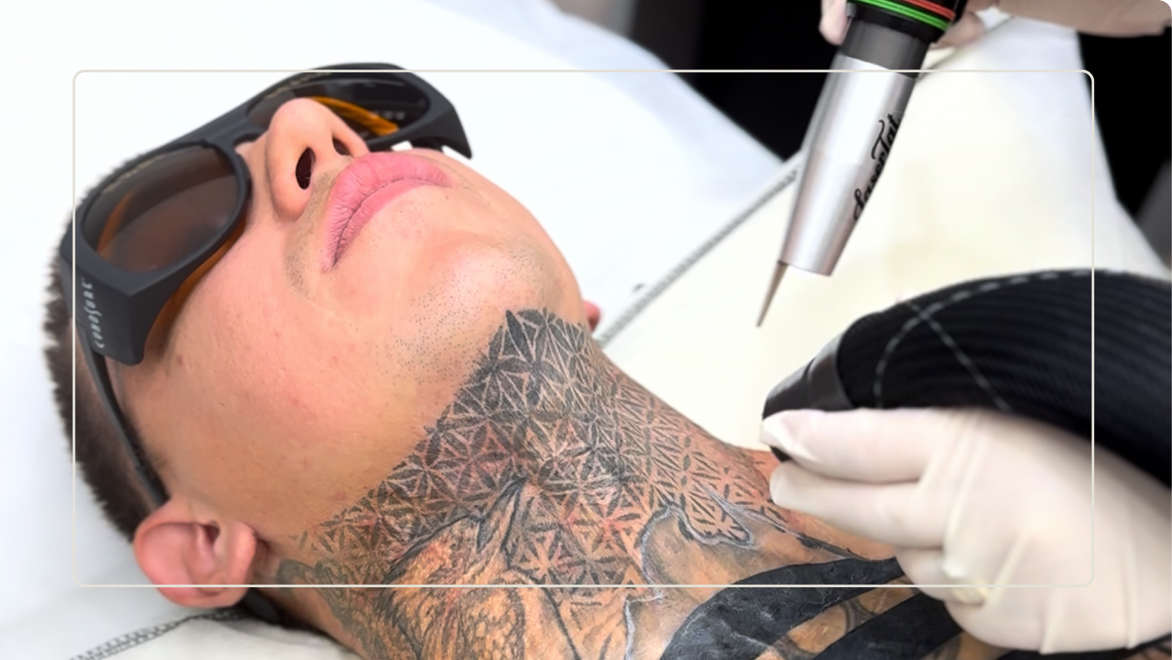 How to feel CONFIDENT going into your next laser session