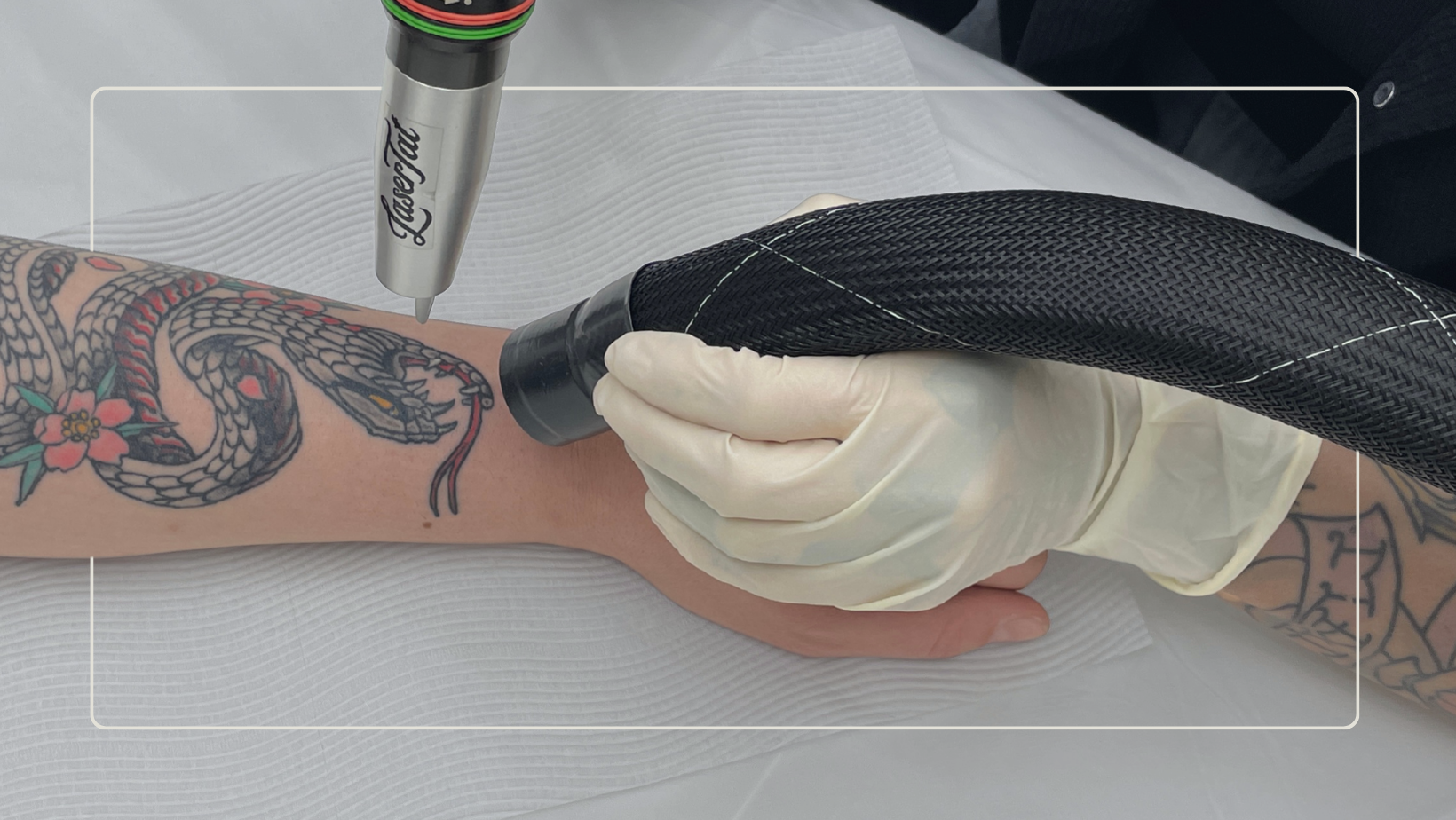 Changed your mind about your tattoo? Here is what Adelaide locals are doing about it