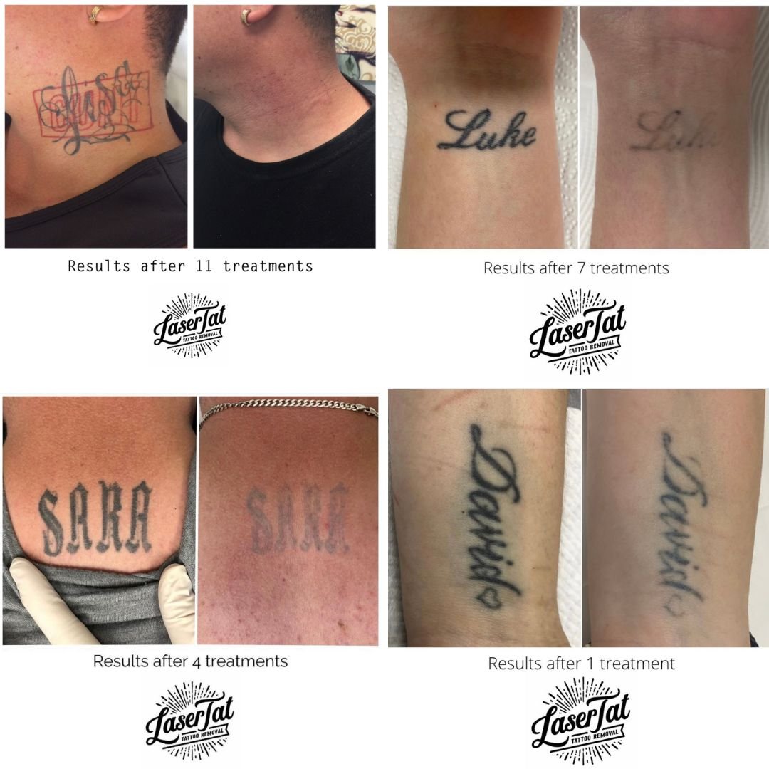 Have you ever wondered what the most common tattoos we remove are? — LaserTat