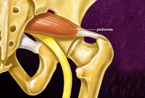 Image: img.webmd.com