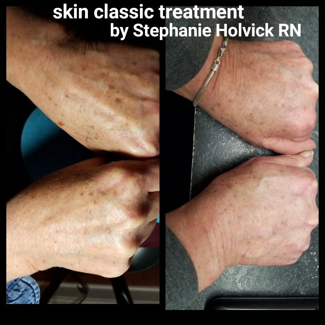 skin-classic-7.jpg