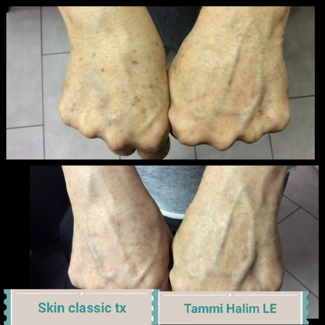 skin-classic-8.jpg