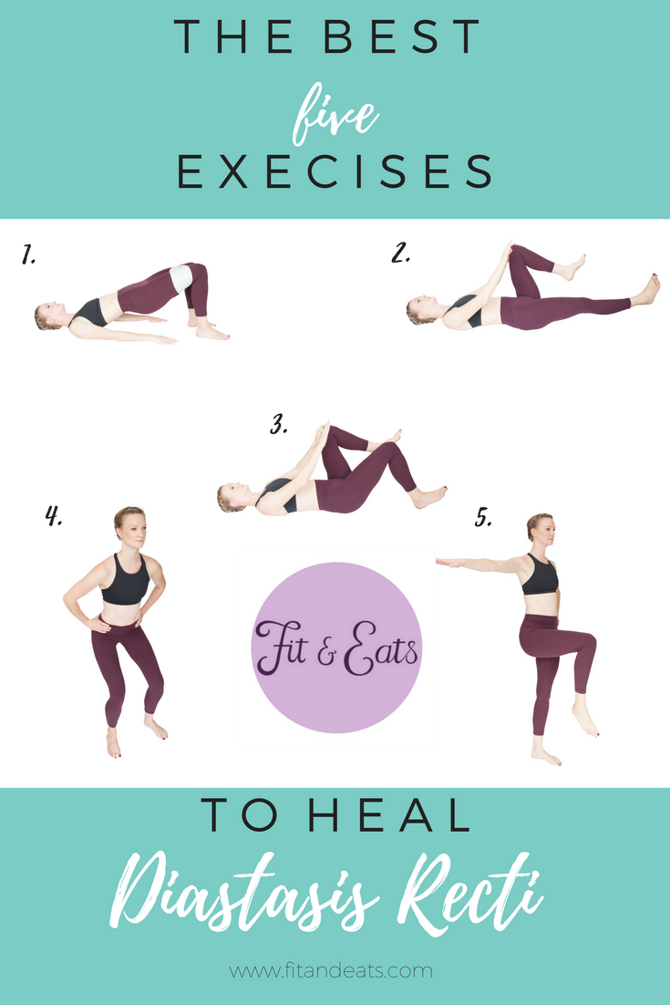 5 Exercises To Heal Diastasis Recti