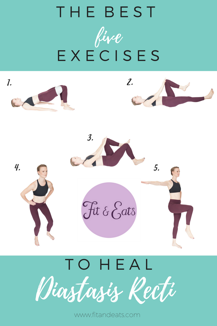 3 Tips to Help Diastasis Recti Recovery