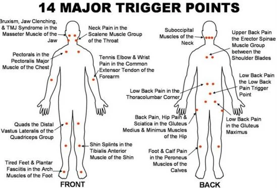 Every wonder what, how, who a Trigger Point is?