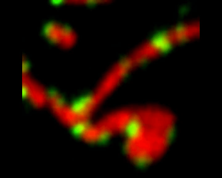 MiD51 (green) on mitochondria (red)