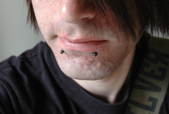 Shocking: Guy With Snakebite Piercings Isn't "Ready for a Relationship Right Now"