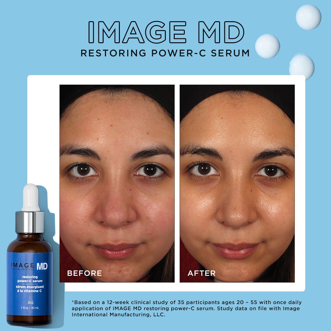 Before and After - IMAGE MD Restoring Power-C Serum