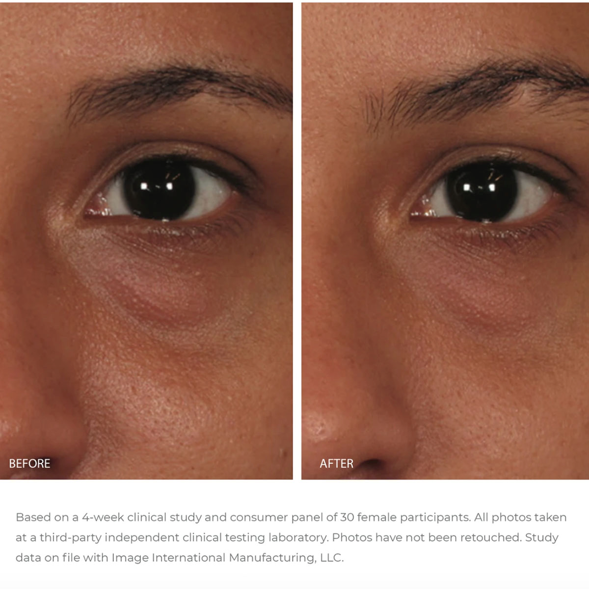 Before and After - ORMEDIC Balancing Eye Lift Gel