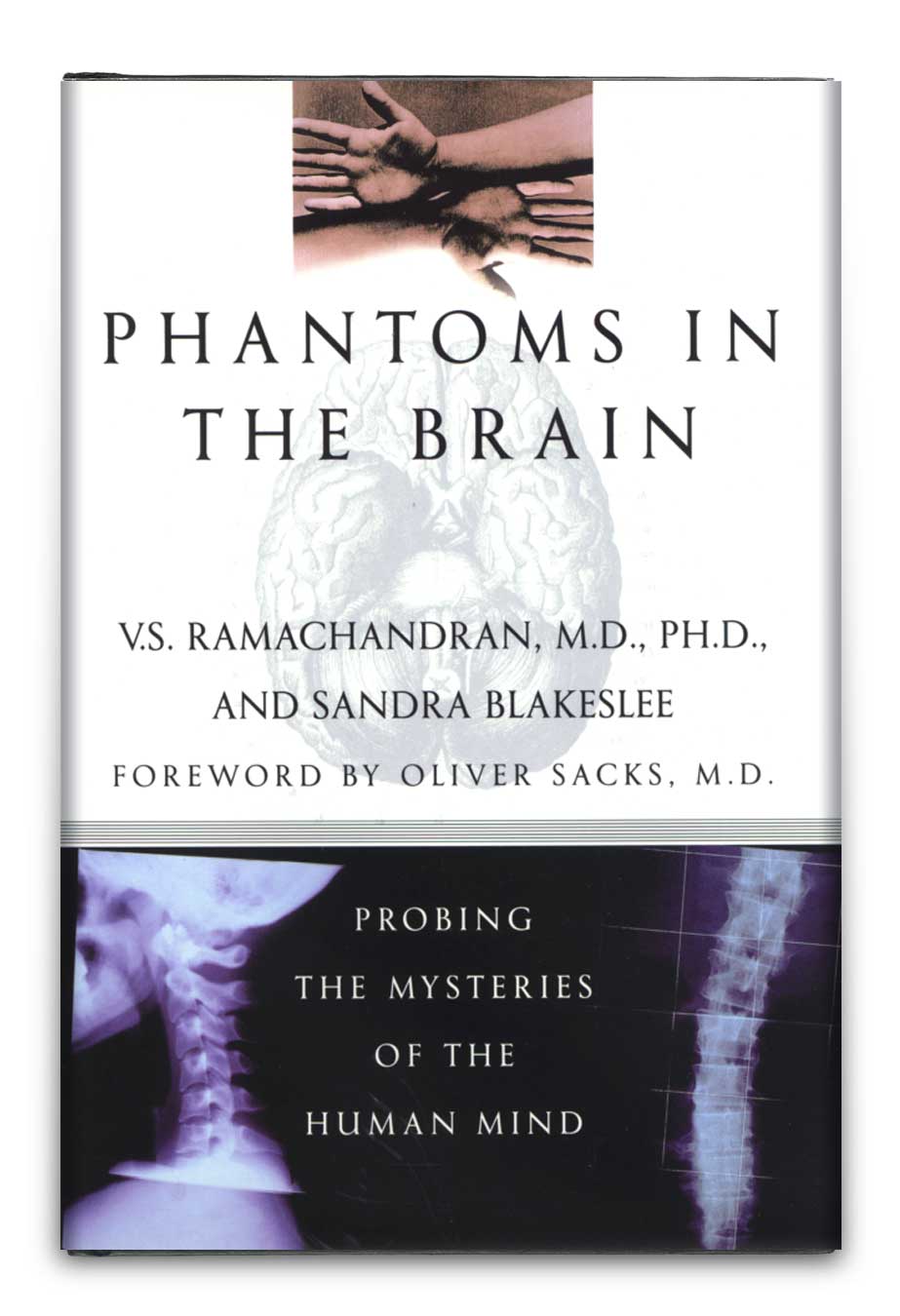 PHANTOMS IN THE BRAIN