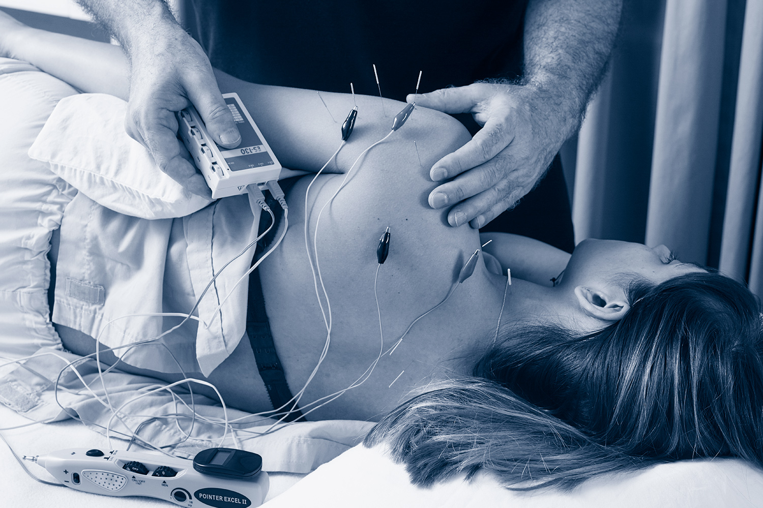 New York City: Neurofunctional Acupuncture: Upper Extremity Treatment Strategies