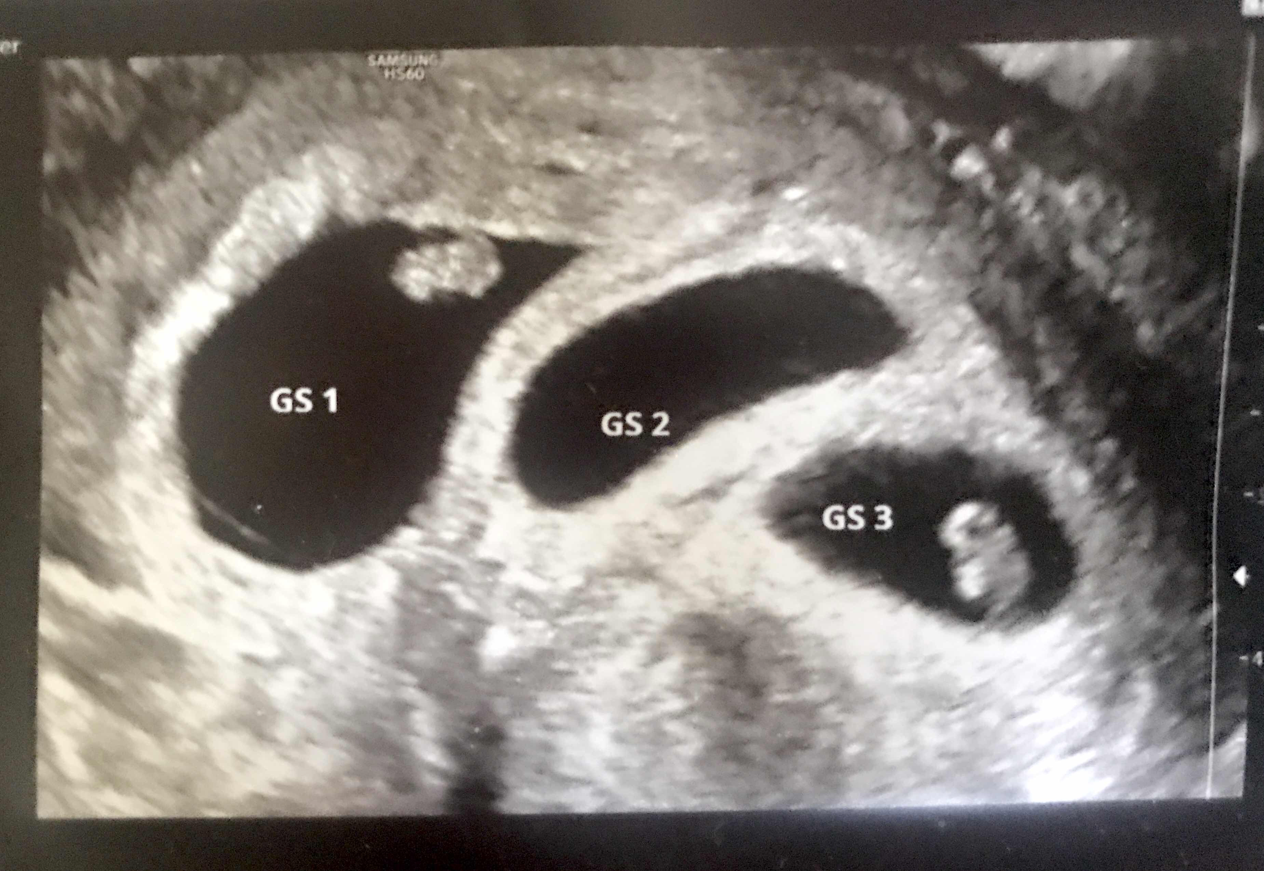 Seven weeks