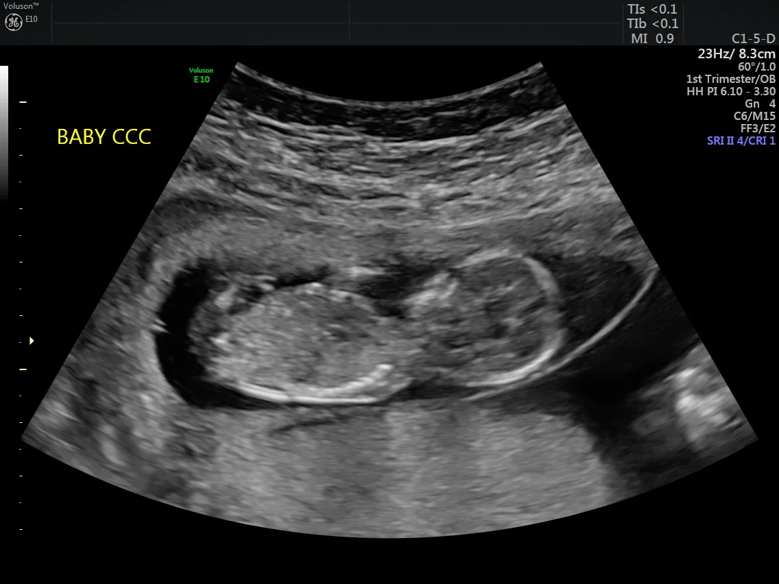 Thirteen weeks