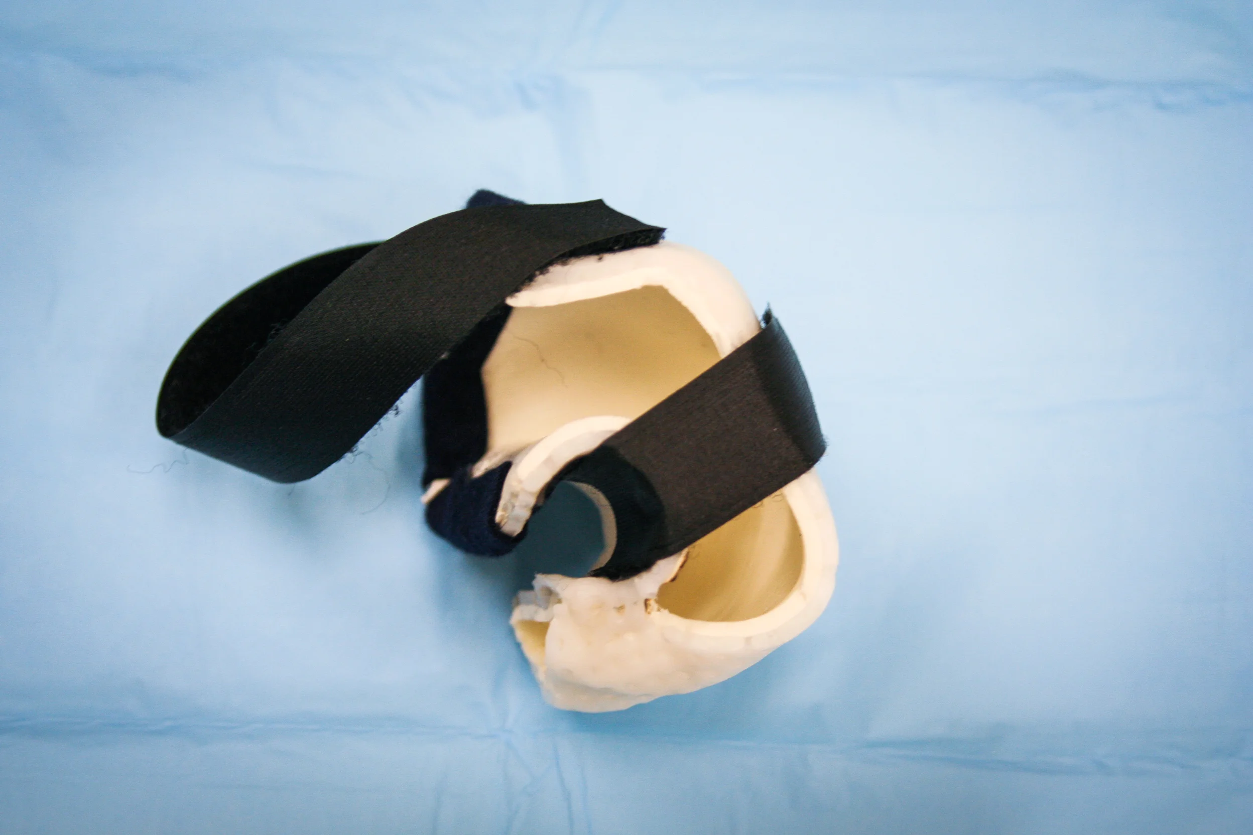 Splints-14.jpg