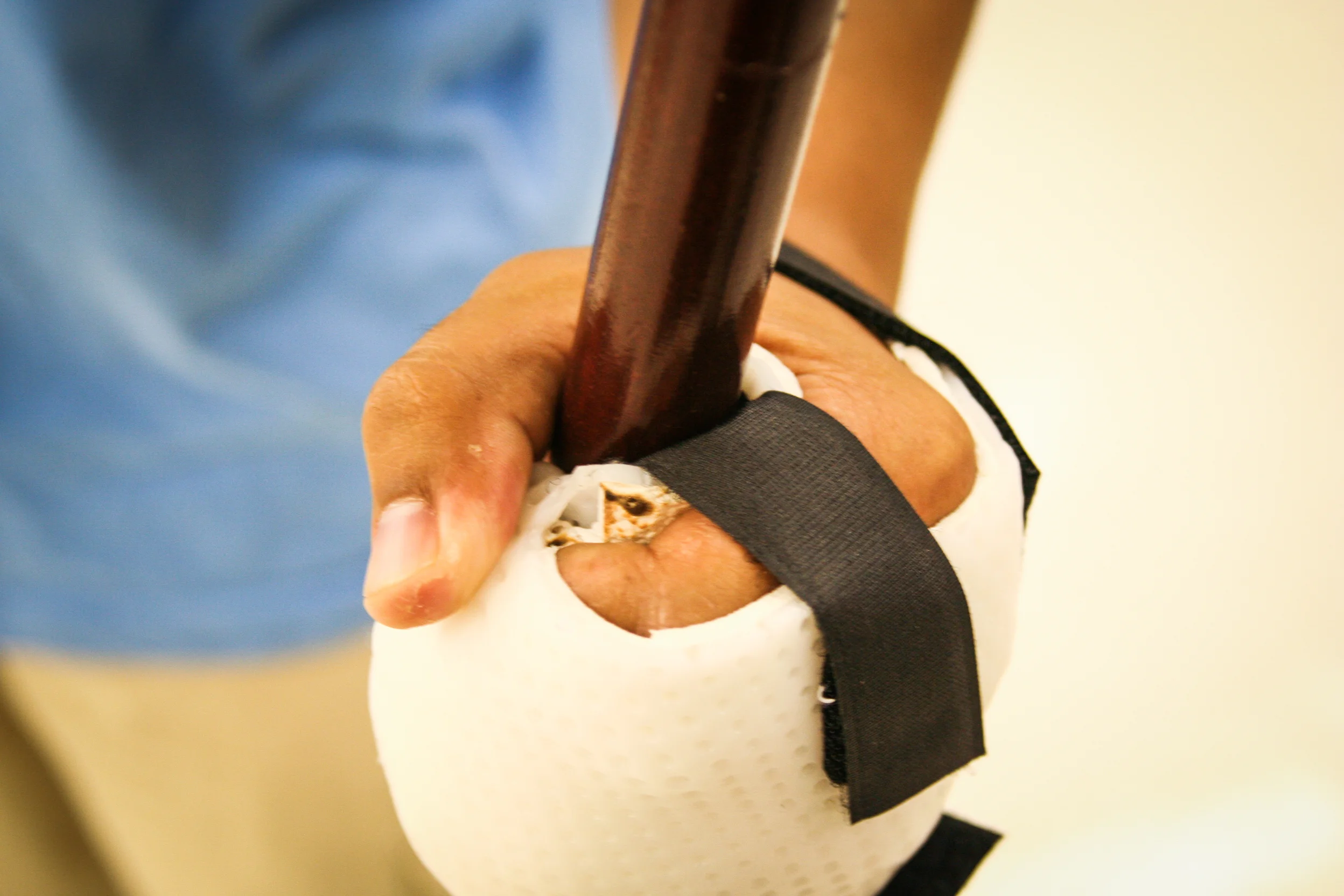 Splints-20.jpg