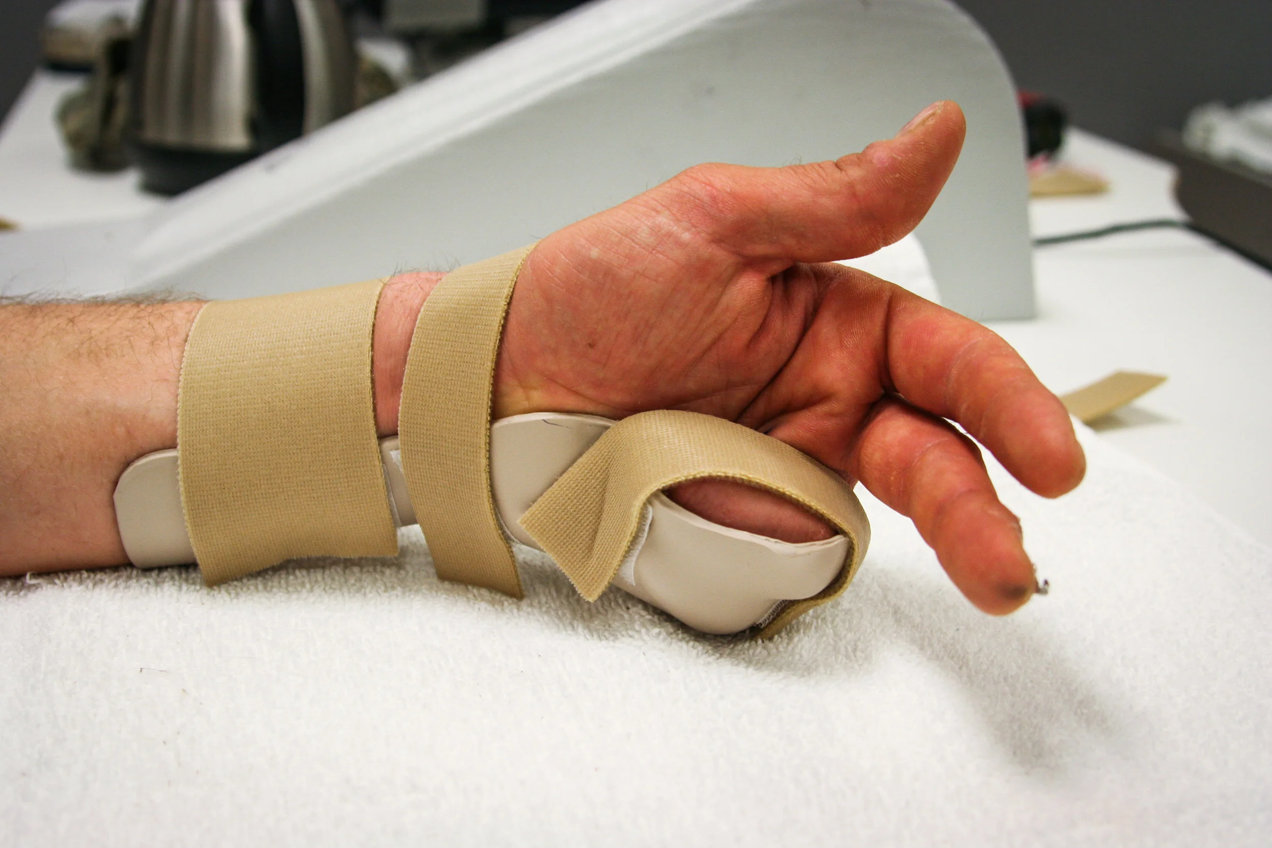 Splints-26.jpg