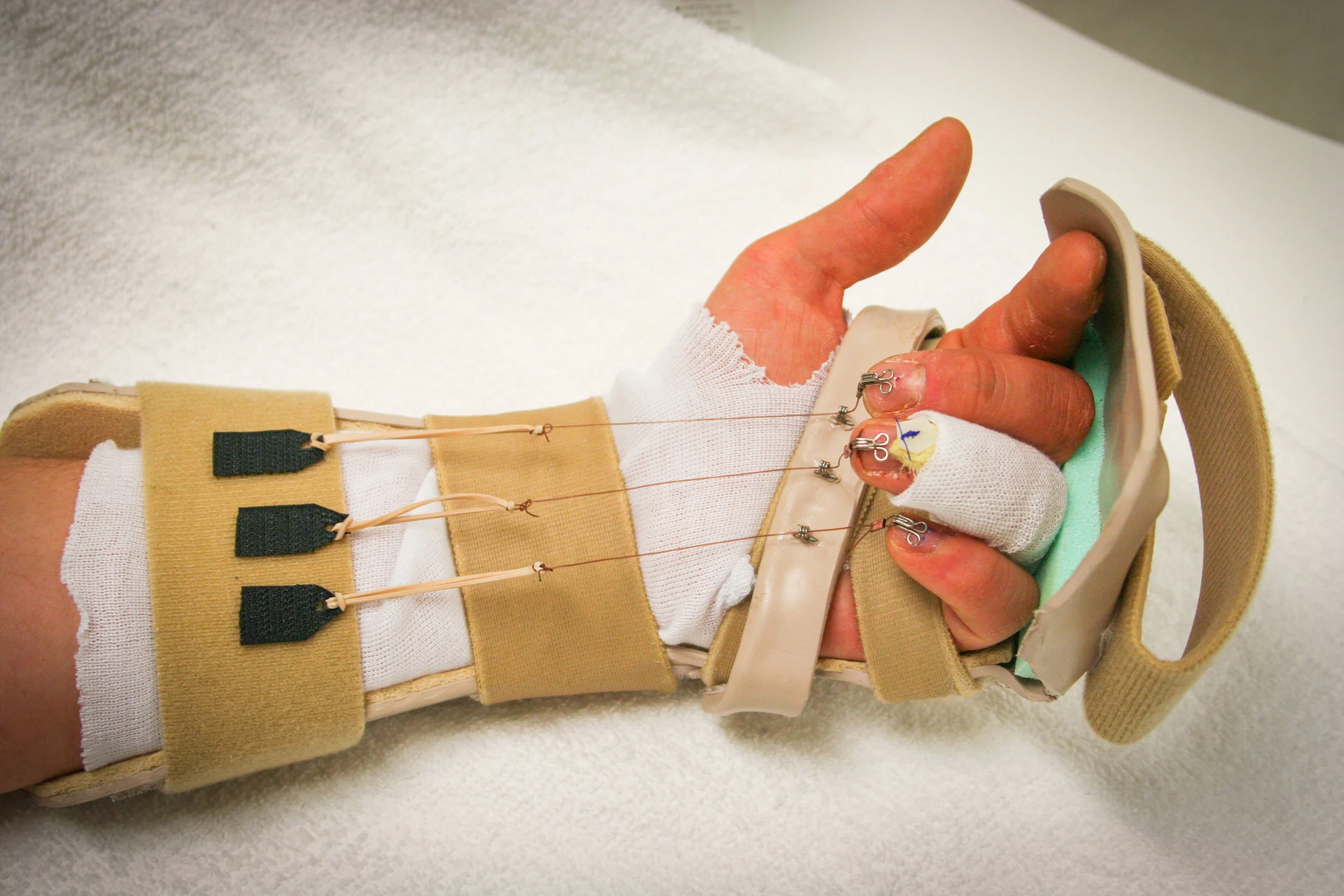 Splints-29.jpg