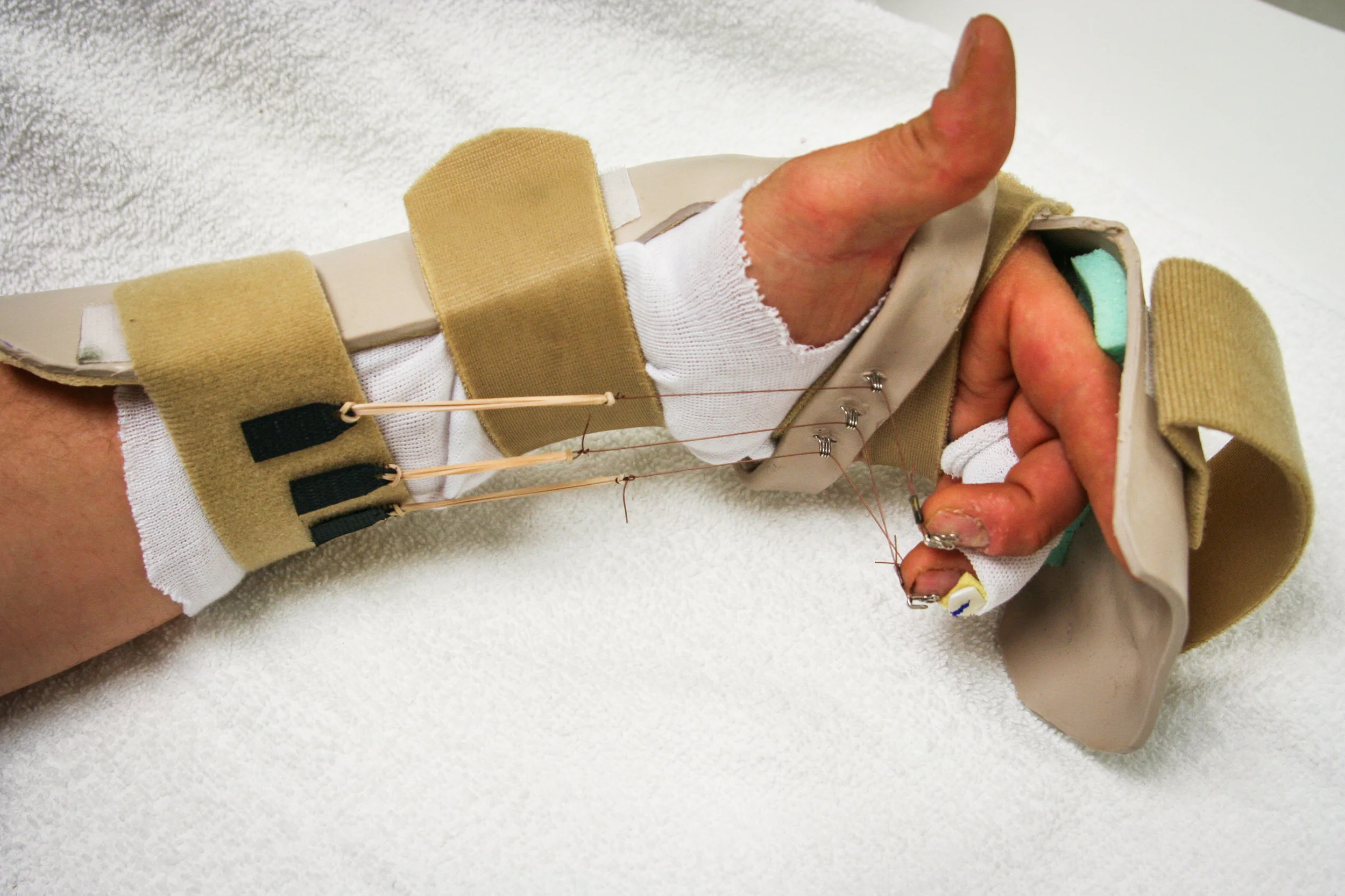 Splints-30.jpg