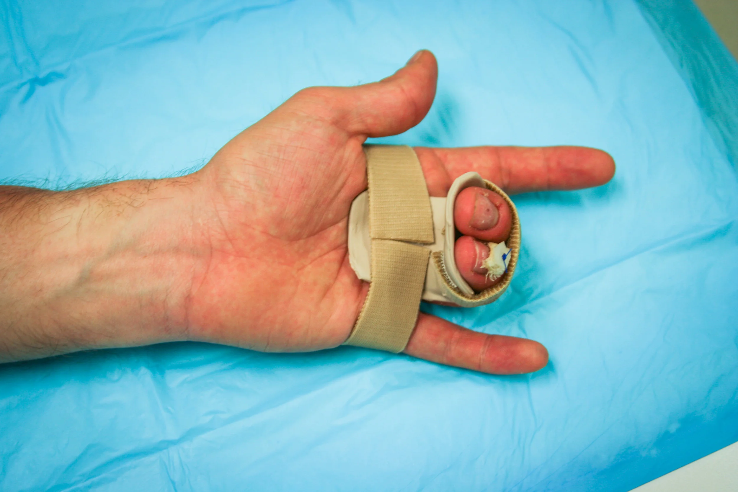 Splints-31.jpg