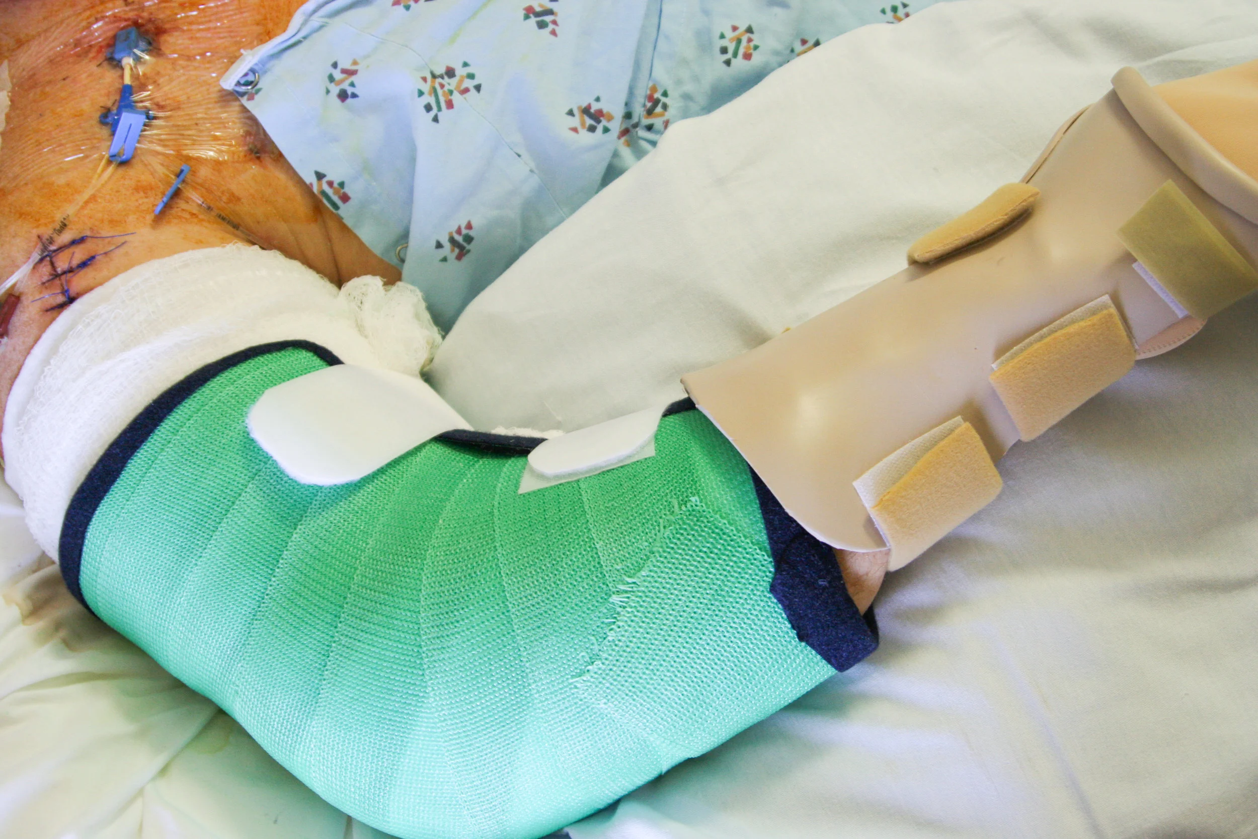 Splints-36.jpg
