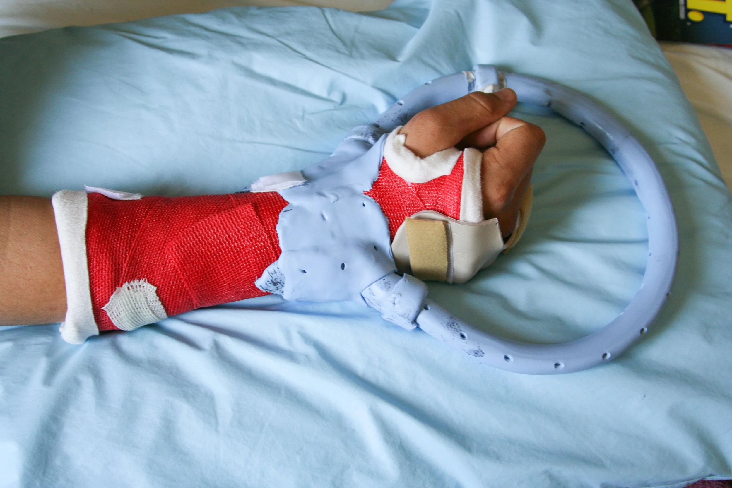 Splints-37.jpg