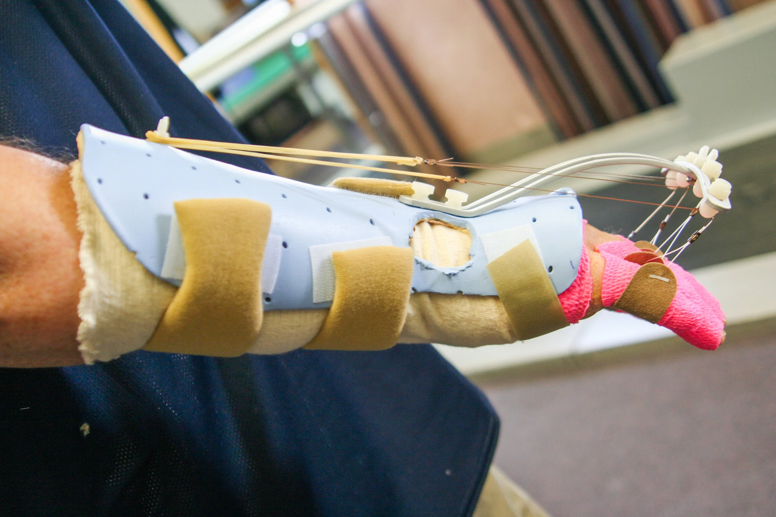 Splints-42.jpg