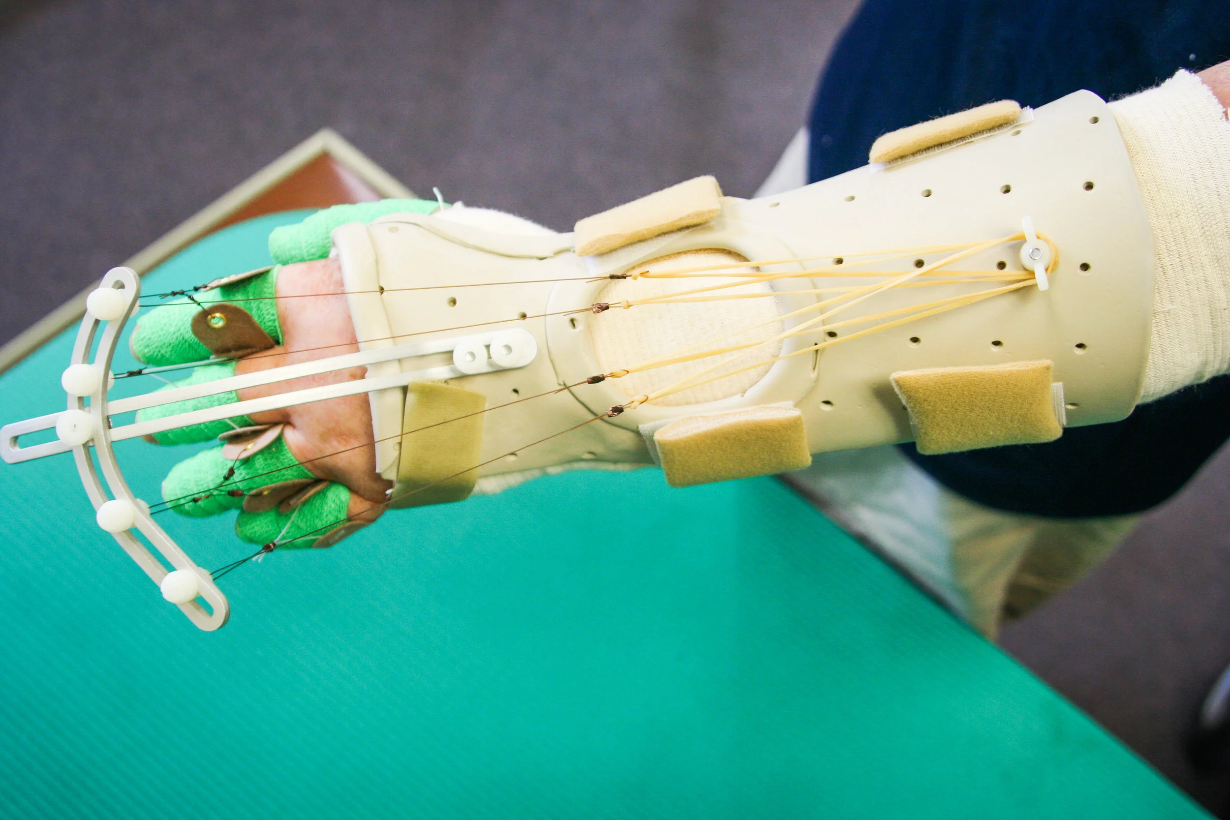 Splints-43.jpg