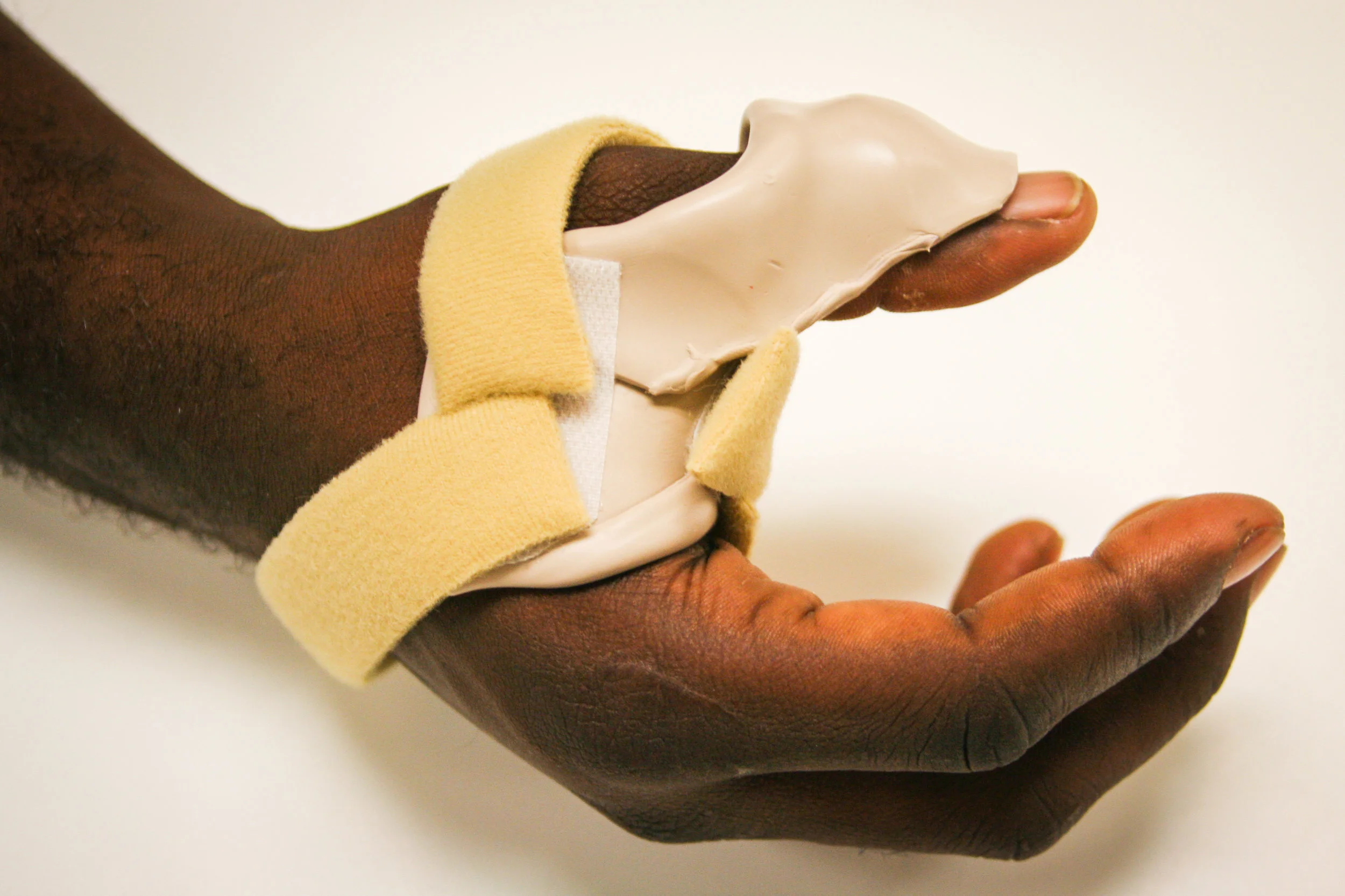 Splints-58.jpg