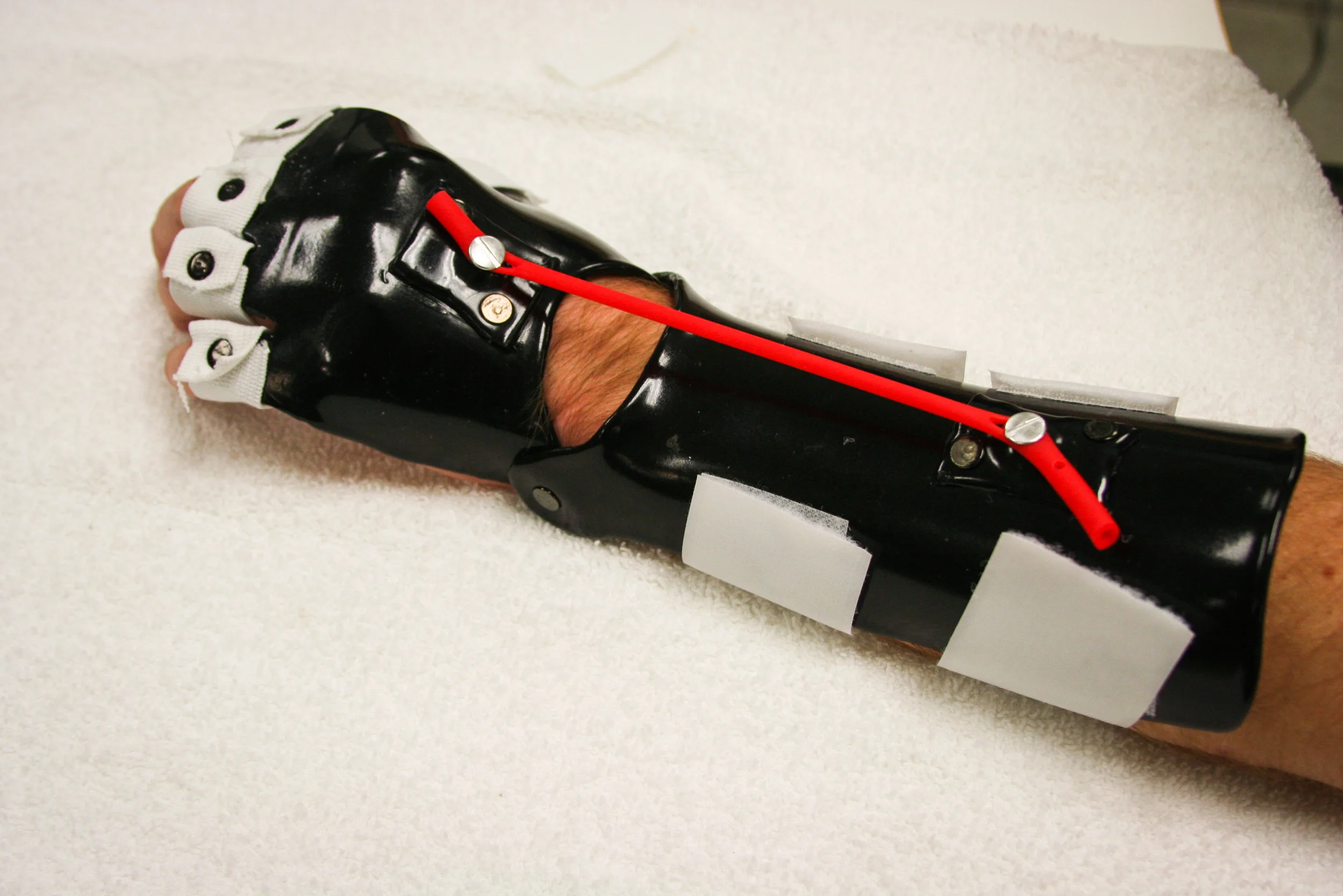 Splints-64.jpg