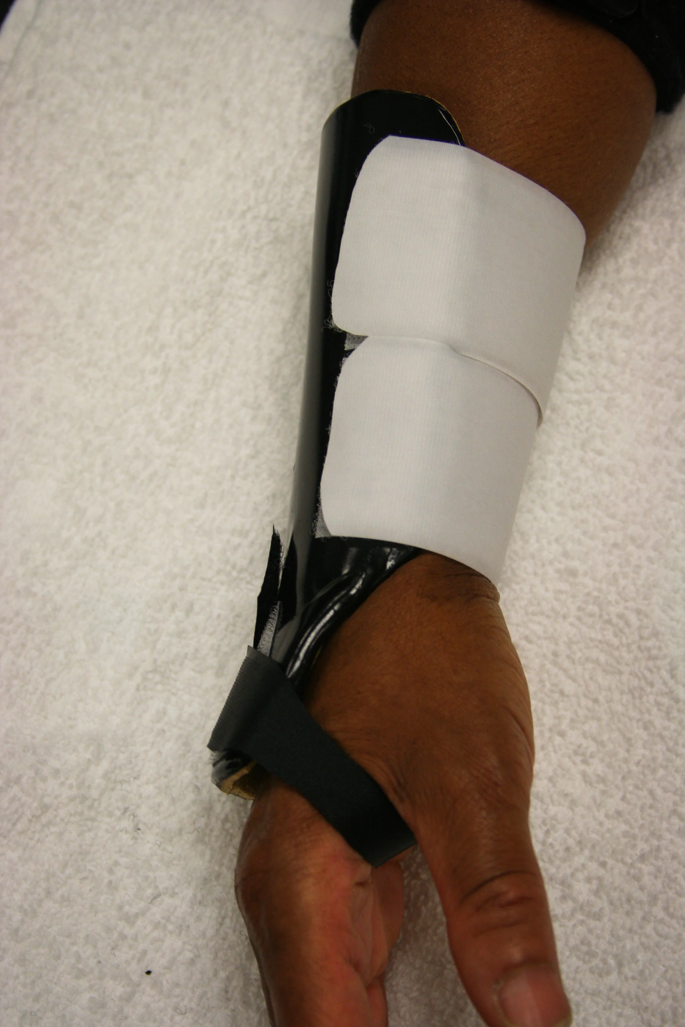 Splints-81.jpg