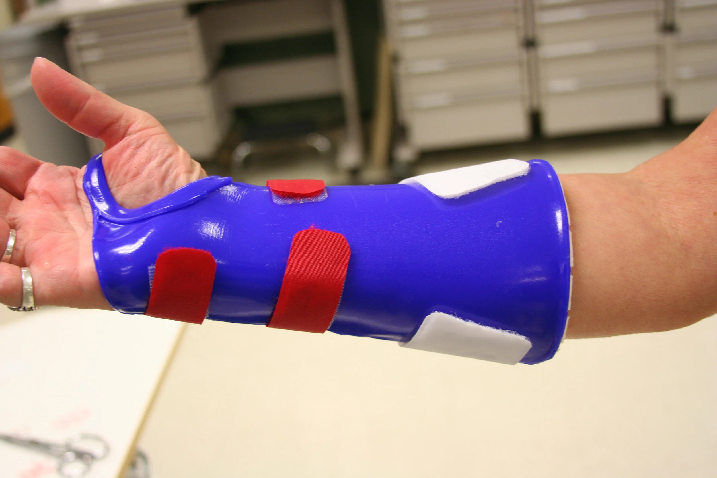 Splints-118.jpg