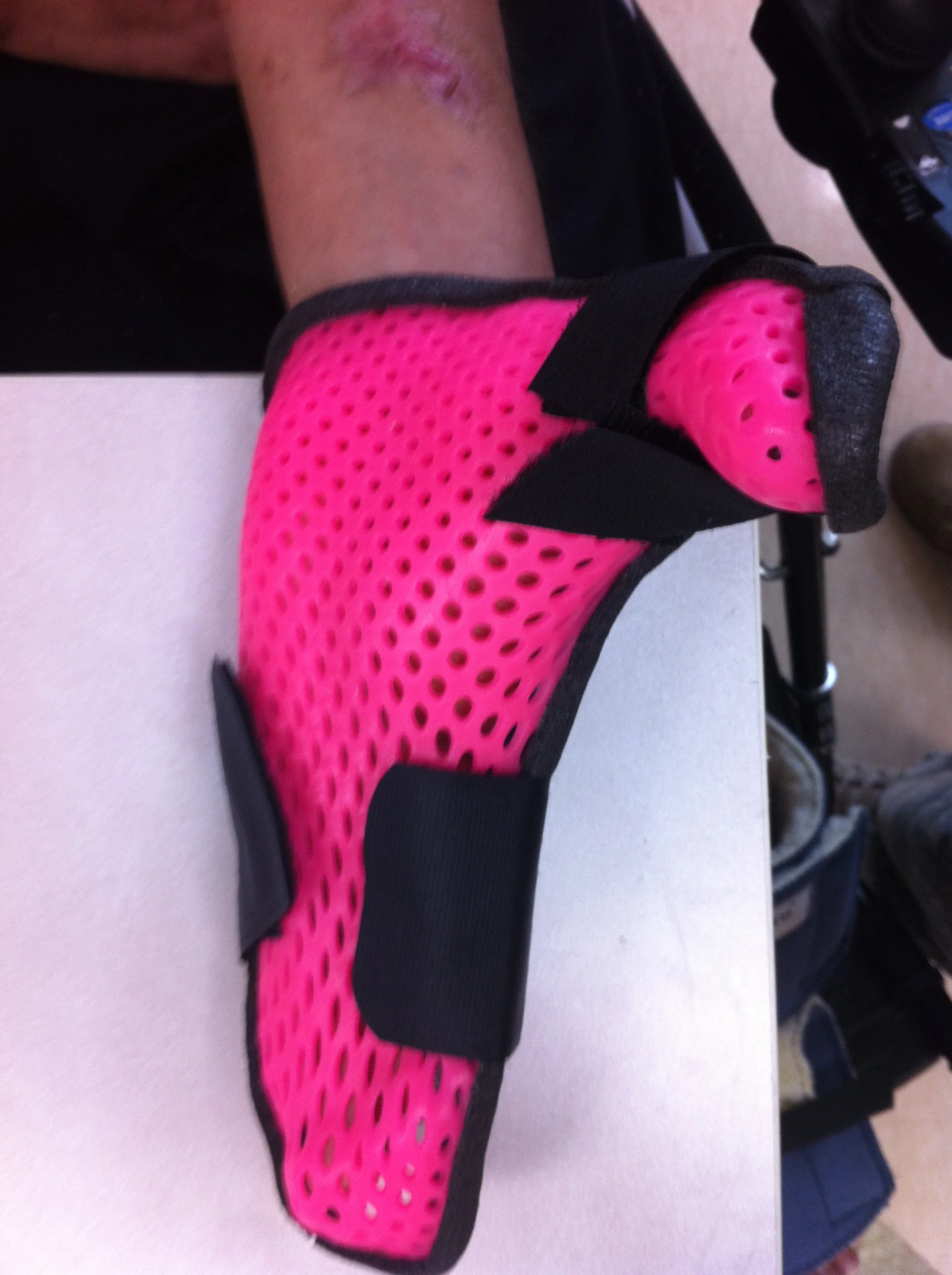 Splints-142.jpg