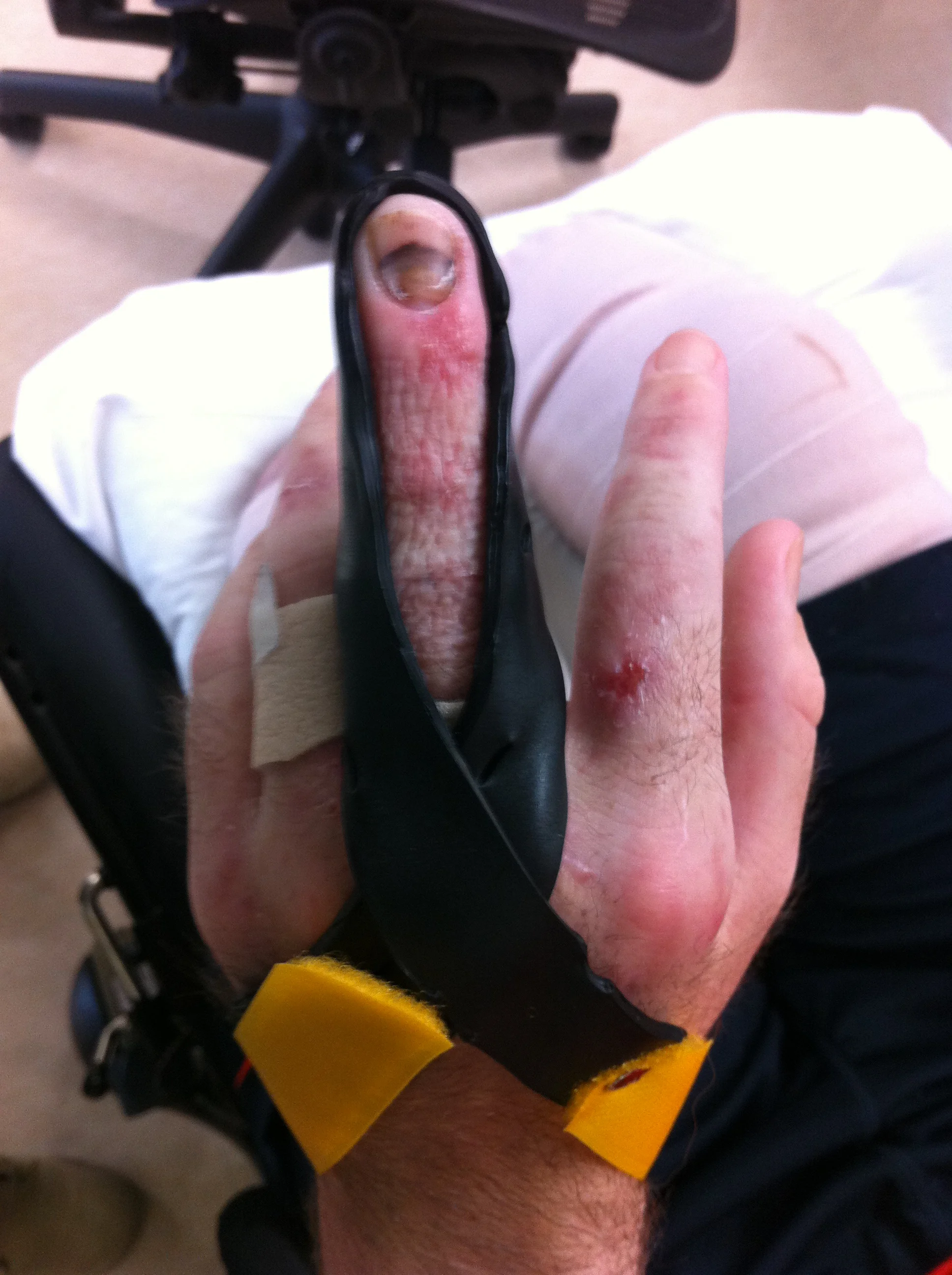 Splints-158.jpg